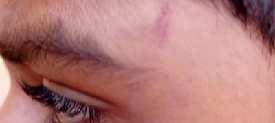 ஆசிரியரின் தாக்குதலுக்குள்ளான மாணவன் வைத்தியசாலையில் அனுமதி !