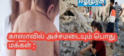 காஸாவில் அச்சமடையும் பொது மக்கள் ; குழந்தைகளிடையே பரவும் தோல் நோய்