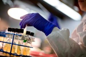 ஈ.கோலை (E. coli) பாக்டீரியாவை அழிக்க செயற்கை நுண்ணறிவைப் (AI) பயன்படுத்தி புதிய வைரஸை உருவாக்கிய ஸ்டான்ஃபோர்ட் விஞ்ஞானிகள்